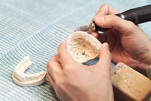 愛媛県でインプラント治療をお考えの方必見！2025年最新版の選び方と成功のポイント